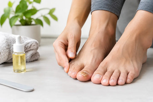 Damaged Toenail Recovery Starts With Consistency