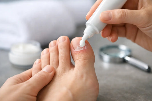 How to Apply Topical Antifungal Accurately